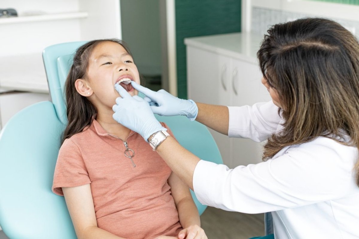 Invisalign palatal expander appliance — used to widen narrow upper arches in children, an option Dr. Siju George provides at Wassan Dental Centre, Muscat